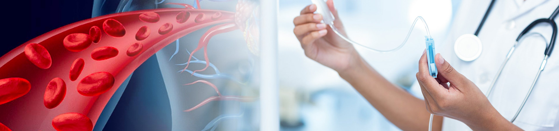 Imagen de un médico sosteniendo una sonda y el diagrama de una vena